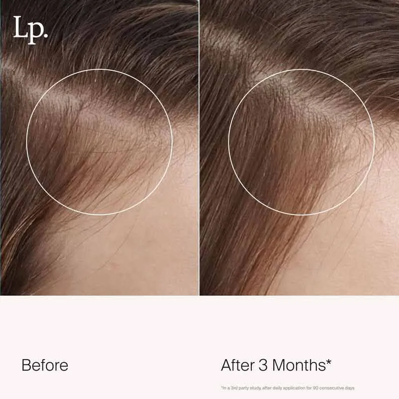 Living Proof Scalp Care Revitalizing Treatment