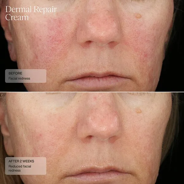 Senté Dermal Repair Cream